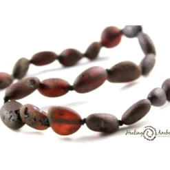 Healing Amber Teething Necklaces>Baltic Amber Teething Necklace - 17.5 Inch